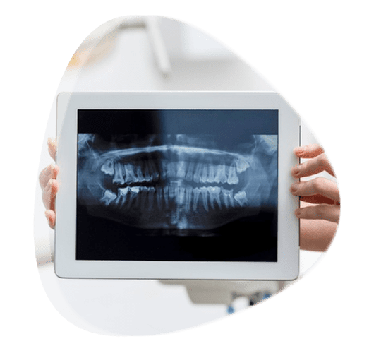 Cirujanos dentistas en Tlalnepantla de Baz