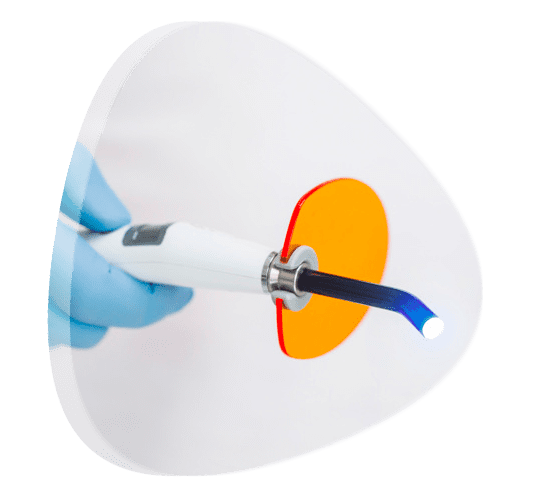 ¿Cómo saber si necesito una limpieza dental con ultrasonido?