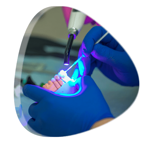 ¿Cómo se colocan las carillas dentales?