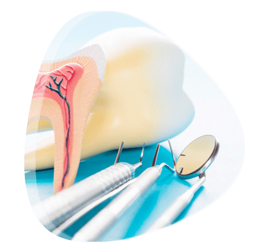 Costo de cirugía de prótesis bucal en Tlalnepantla de Baz