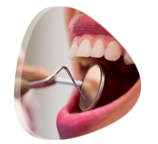 Cuanto cuesta una consulta de Endodoncia en Tlalnepantla de Baz Estado de México