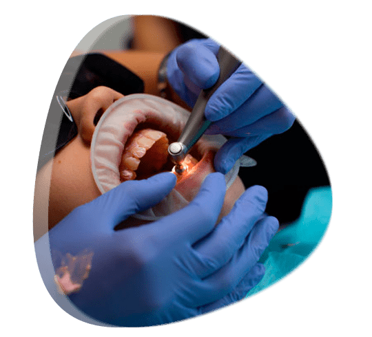 Precio de limpieza dental con ultrasonido