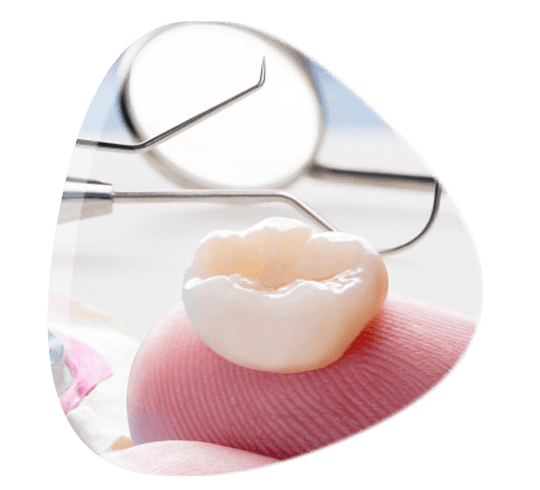 ¿Qué son las fundas dentales?